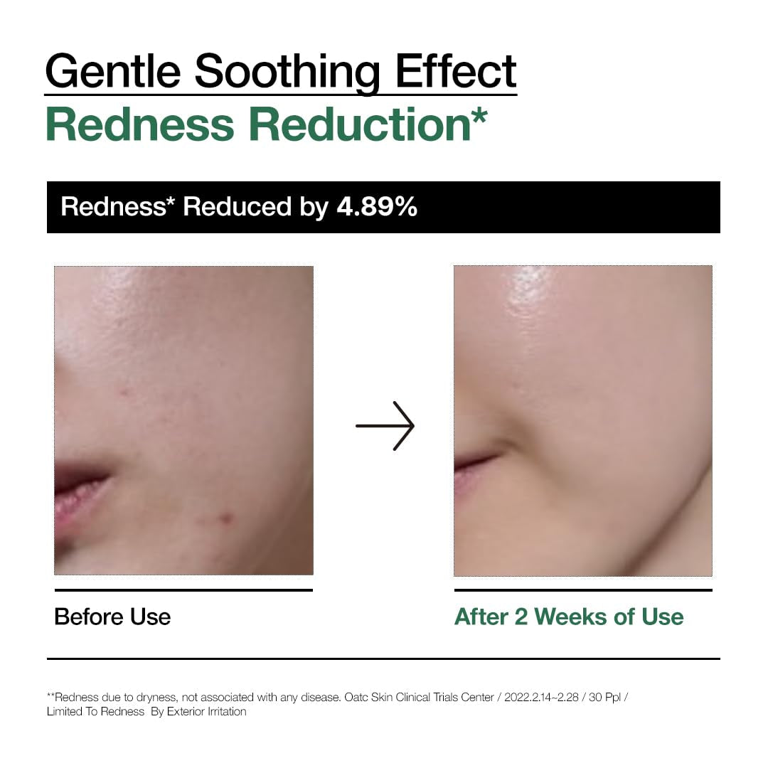 Heartleaf 80 Soothing Ampoule 30Ml / 1.01 Fl.Oz. I Non-Greasy, Highly Concentrated Skin Calm Serum Hydrating Panthenol B5 Calming Treatment Essence for Combination, Sensitive, Normal Skin, Korea